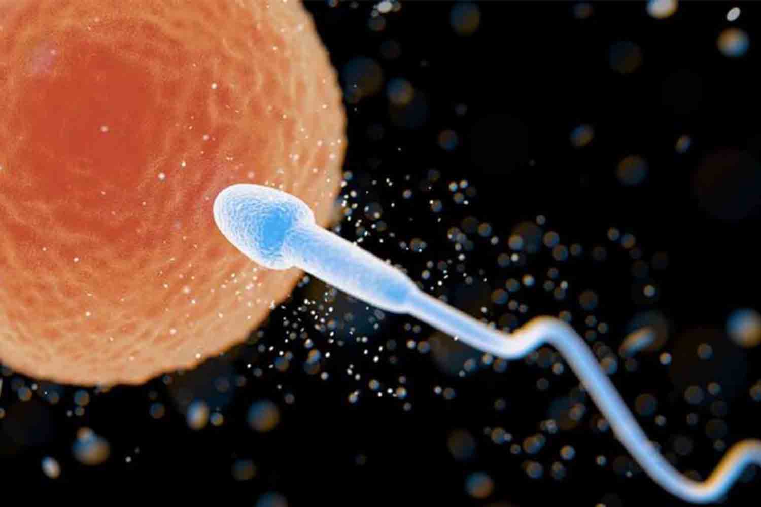 Sperm-Retrieval