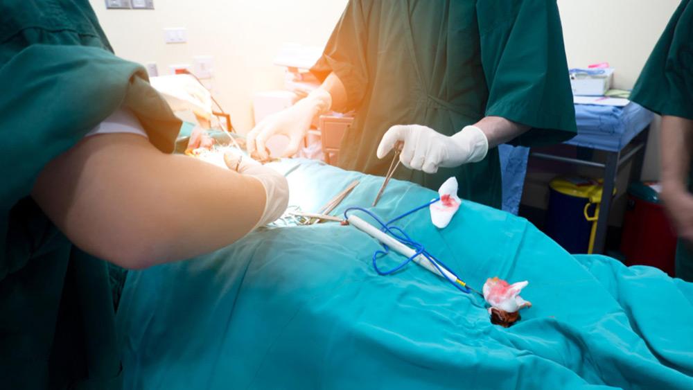 You are currently viewing Why Doctors Prefer Laparoscopic Surgery for Fertility Treatment